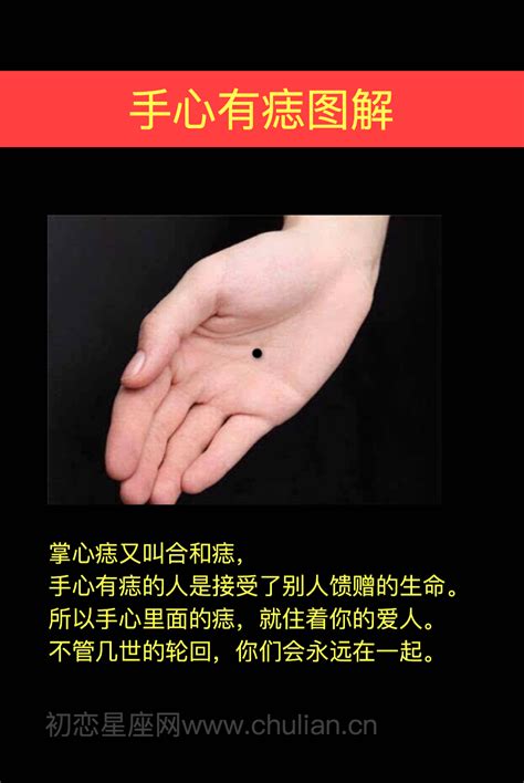 手心痣|手上长痣，有什么痣就有什么运